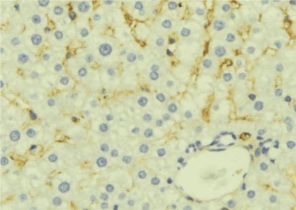 STMN1 / Stathmin / LAG Antibody
