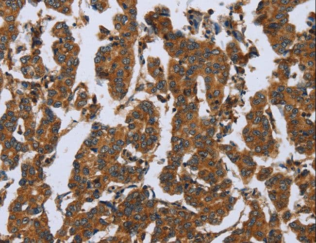 COMP / THBS5 Antibody
