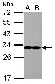 Polyclonal Rabbit anti-Human EIF2B1 Antibody (IHC, WB)
