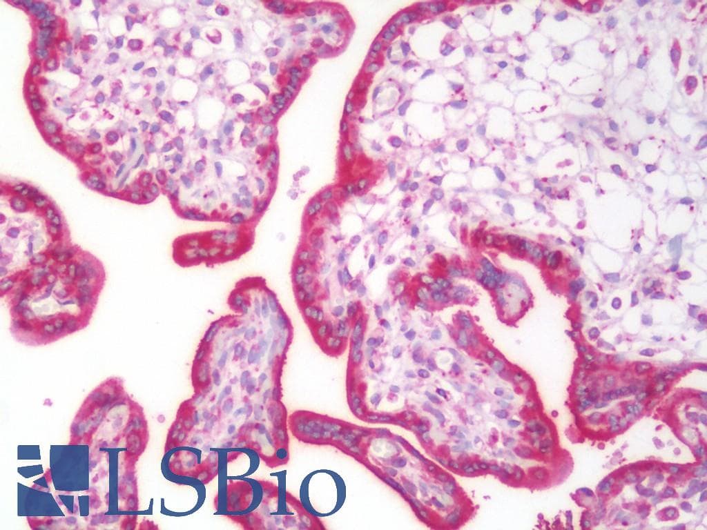 GANAB / Alpha Glucosidase II Antibody (aa47-251)
