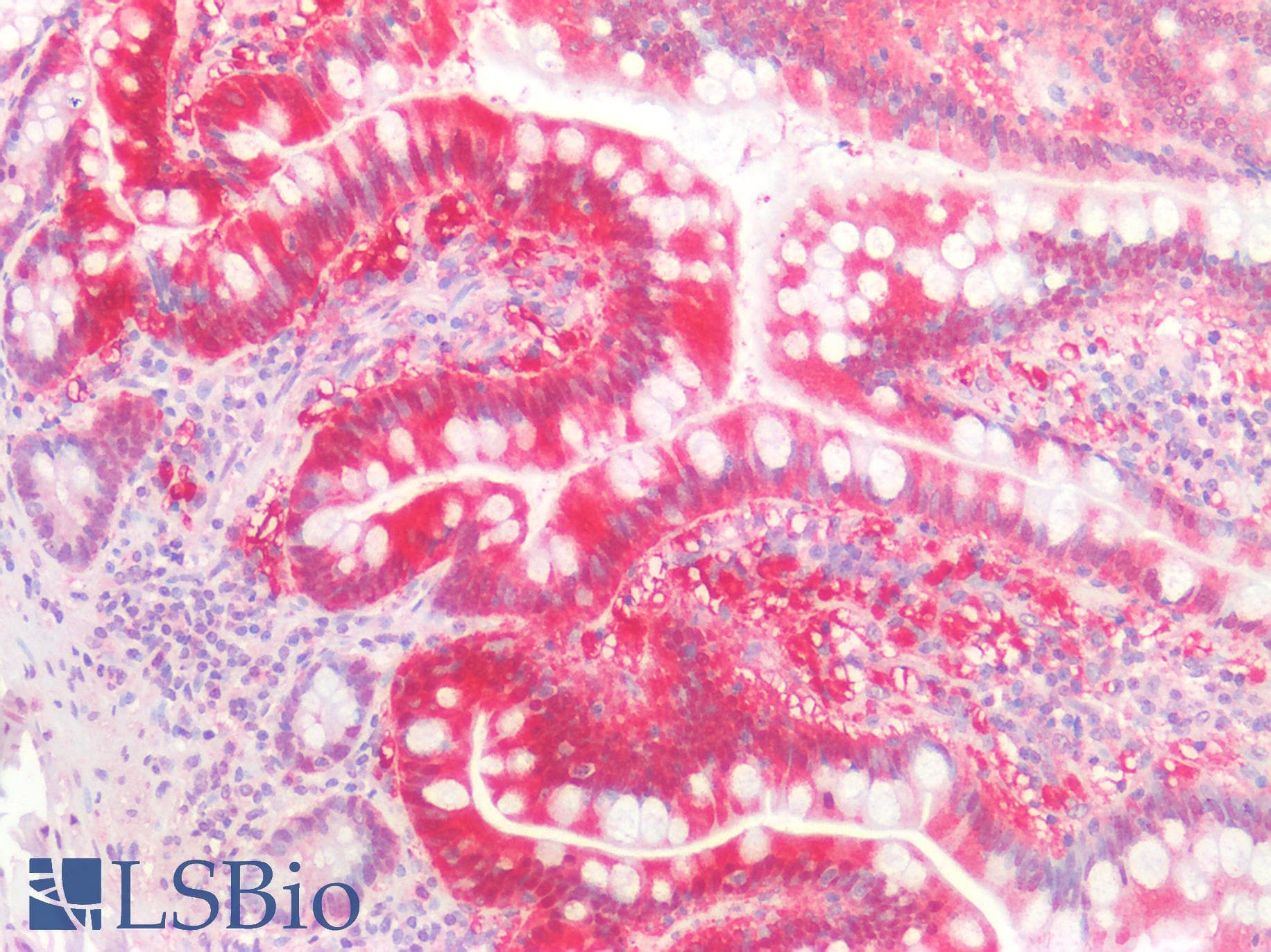 PathPlus™ TMIGD2 Antibody (clone 8G1)