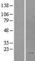 Human IL2 Protein (Over-Expression Lysate Myc-DDK (Flag))