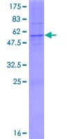 Human AGPAT1 Protein (Recombinant GST)