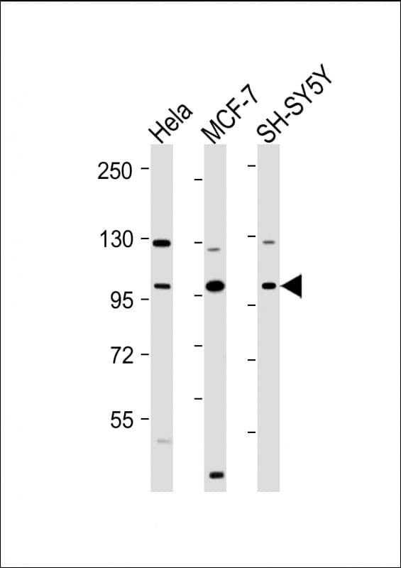 Polyclonal Rabbit anti-Human VAV2 Antibody (N-Terminus, WB)