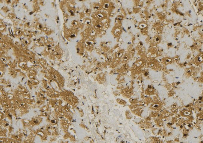 MRPL11 Antibody