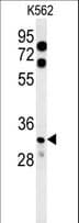 KCTD15 Antibody (aa255-283)