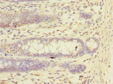 Polyclonal Rabbit anti-Human TRIM17 / RNF16 Antibody (IHC, WB)