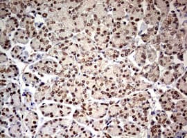 Monoclonal Mouse anti-Human TRIM24 / TIF1 Antibody (clone OTI2D9, aa706-1016, IHC, WB)