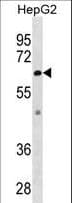 ZMPSTE24 Antibody (aa404-433)
