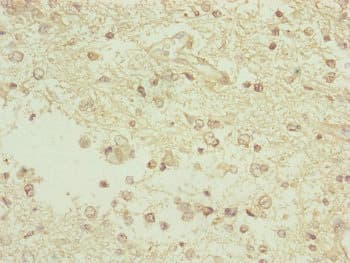 TAMM41 / C3orf31 Antibody