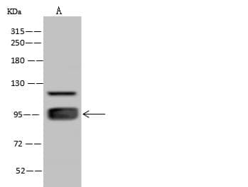 ELAC2 Antibody