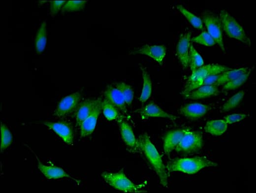 Polyclonal Rabbit anti-Human OS9 Antibody (IHC, IF, WB)