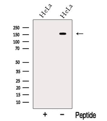 NGN / Neogenin Antibody