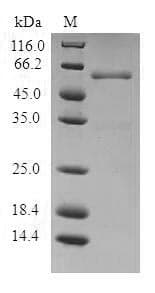 Human PVR / CD155 Protein (Recombinant 6His-SUMO, N-terminus)