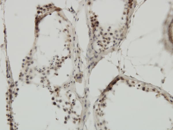 TRIM24 / TIF1 Antibody (clone 2F2)