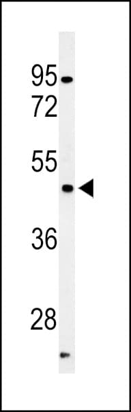 PFTK1 / CDK14 Antibody (aa1-30)