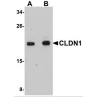 Polyclonal Rabbit anti-Human CLDN1 / Claudin 1 Antibody (IF, WB)