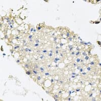 PPAT Antibody