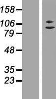 ZC3H11A Protein (Over-Expression Lysate Myc-DDK (Flag))