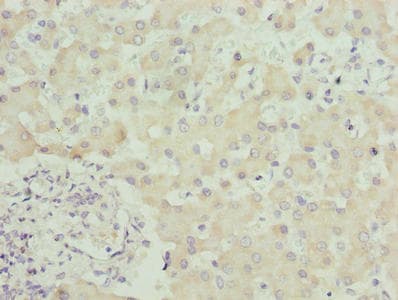 Polyclonal Rabbit anti-Human SPCS3 Antibody (IHC)