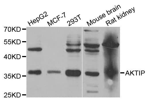 Polyclonal Rabbit anti-Human AKTIP / FTS Antibody (IHC, WB)