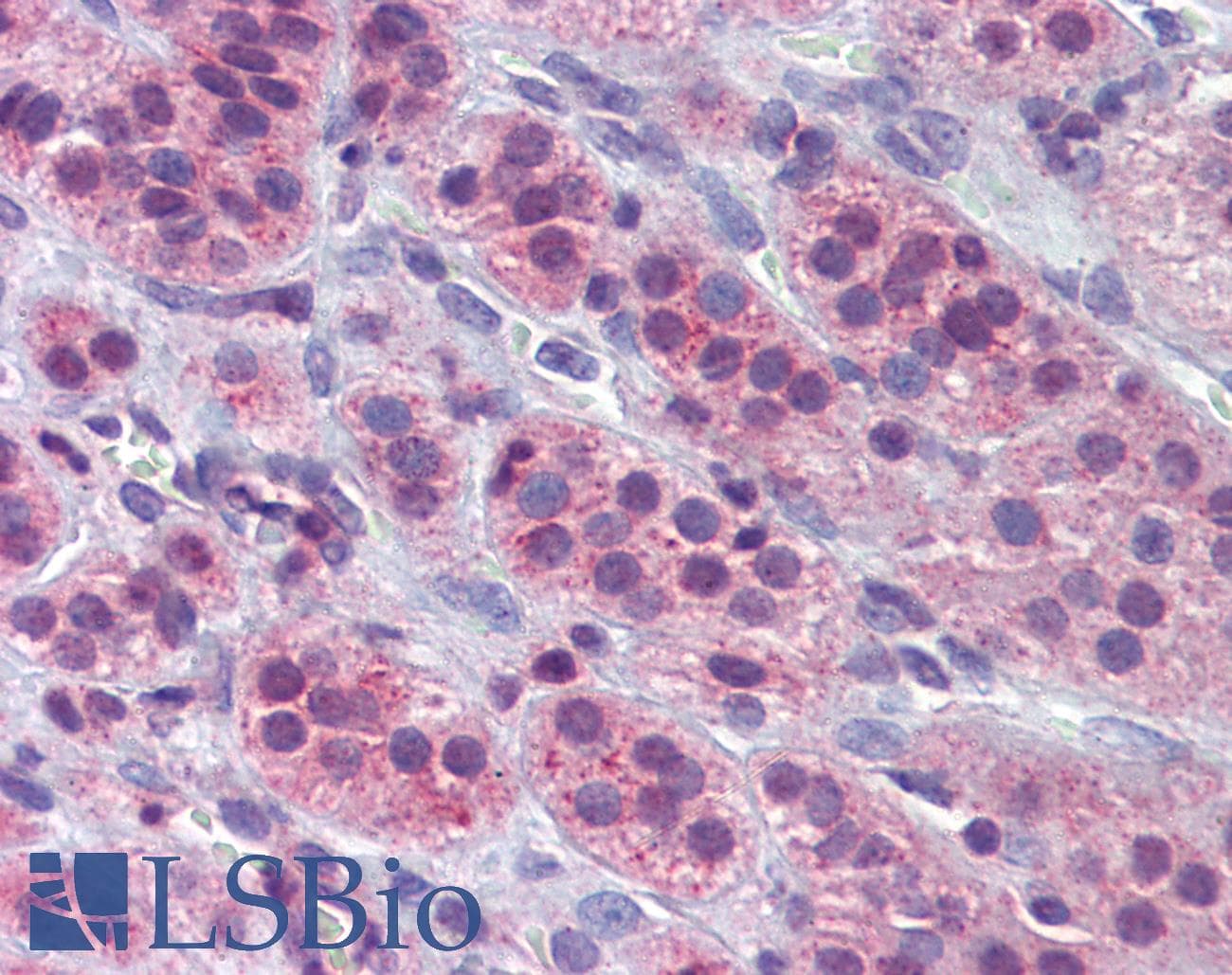 IHC-plus™ Polyclonal Rabbit anti-Human ENO1 / Alpha Enolase Antibody (aa178-205, IHC, IF, WB)