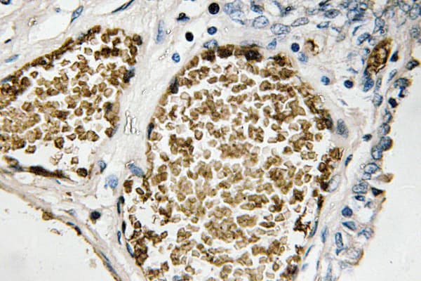 Polyclonal Rabbit anti-Human FOSB Antibody (Ser23, IHC, IF, WB)