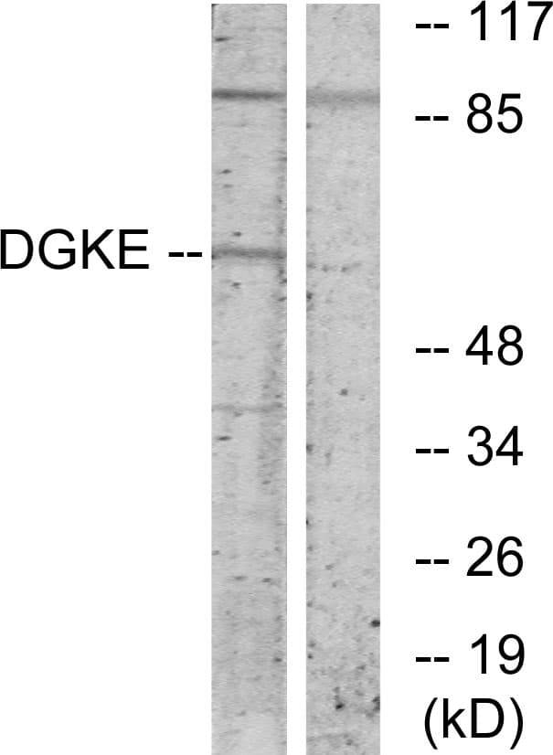 Polyclonal Rabbit anti-Human DGKE / DGK Epsilon Antibody (aa161-210, WB)