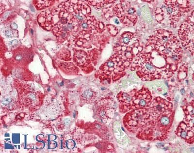 PathPlus™ HSPD1 / HSP60 Antibody (aa511-560)