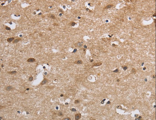 SDCCAG3 Antibody