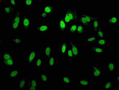 Recombinant Monoclonal Rabbit anti-Human HIST1H3A Antibody (IF, WB)