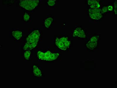 UHMK1 / KIS Antibody