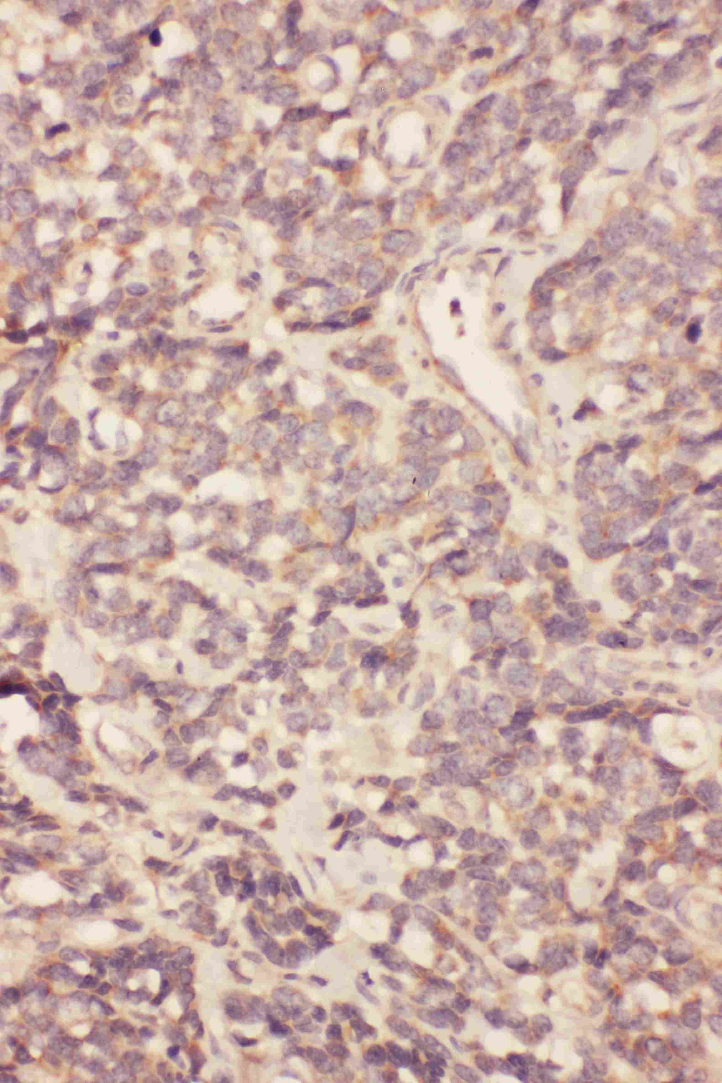 FGF19 Antibody (aa124-140)