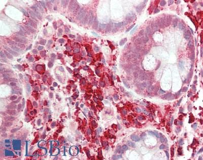 SIK3 / QSK Antibody (aa350-400)