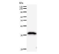 BTG1 Antibody (clone 2095C1a)