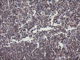 DEF6 Antibody (clone OTI2G2)