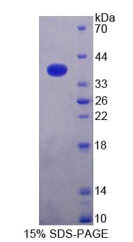 Human Alpha SNAP Protein (Recombinant His-T7)
