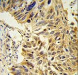 Polyclonal Rabbit anti-Human SDR / SDPR Antibody (aa109-135, IHC, WB)