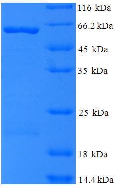 Moloney Murine Leukemia Virus MuLV gag Protein (Recombinant 6His-SUMO, N-terminus)