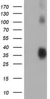 ZFP36 / Tristetraprolin Antibody (clone OTI5E3)