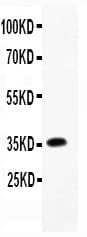 Polyclonal Rabbit anti-Rat CCL4 / MIP-1 Beta Antibody (aa24-92, WB)