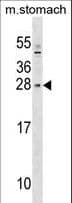 Polyclonal Rabbit anti-Human SIX6 Antibody (aa96-124, WB)