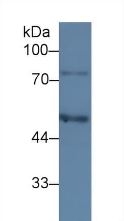 SERPING1 / C1 Inhibitor Antibody (aa399-500, clone C2)