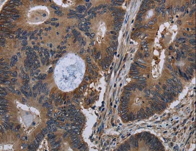 TSC22D3 / GILZ Antibody