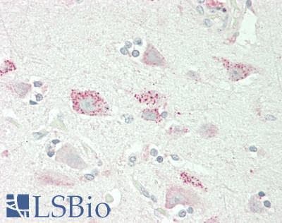IHC-plus™ Polyclonal Rabbit anti-Human RUNX1T1 / ETO Antibody (aa554-604, IHC, WB)