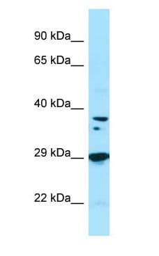 PPP1CB Antibody (C-Terminus)