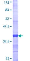 Human SC5D / ERG3 Protein (Recombinant GST)