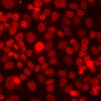 SETD2 Antibody
