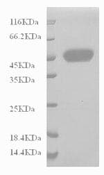 Human CD14 Protein (Recombinant 6His, N-terminus)