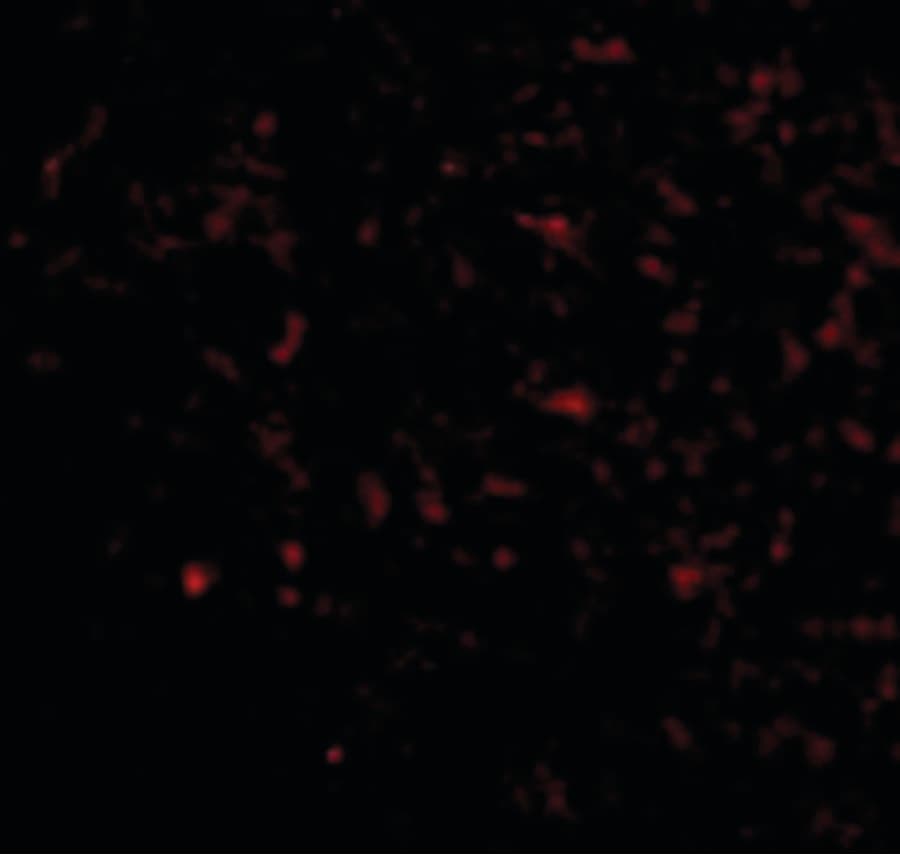 IHC-plus™ GRIK5 / KA2 Antibody